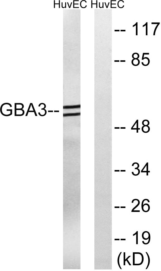 CBG Rabbit Polyclonal Antibody