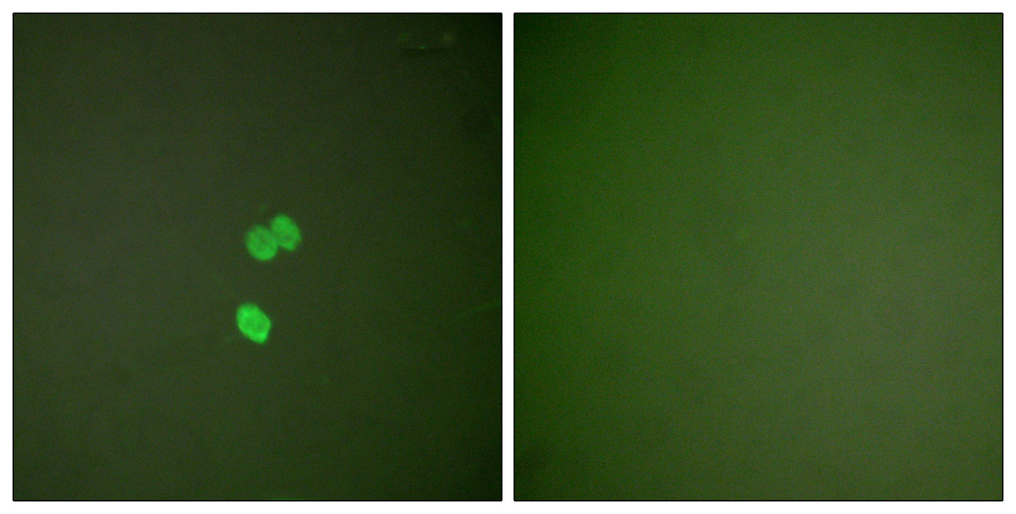 CBP 35 Rabbit Polyclonal Antibody