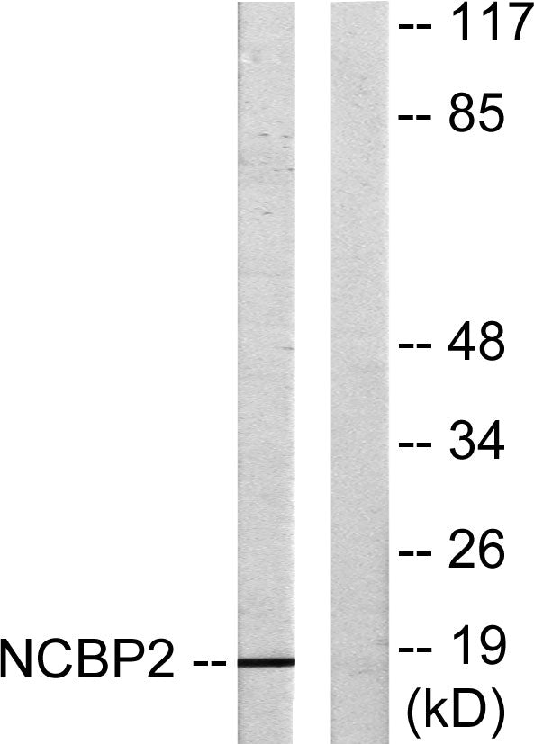 CBP20 Rabbit Polyclonal Antibody