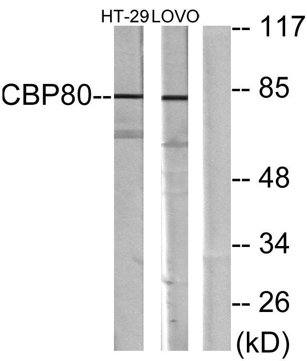 CBP80 Rabbit Polyclonal Antibody