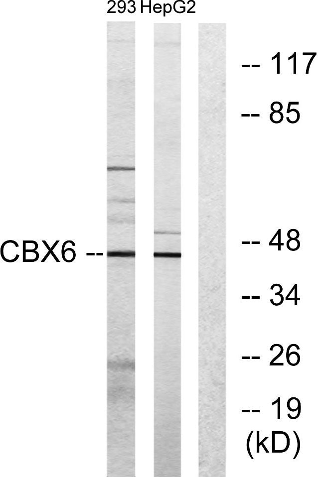 CBX6 Rabbit Polyclonal Antibody