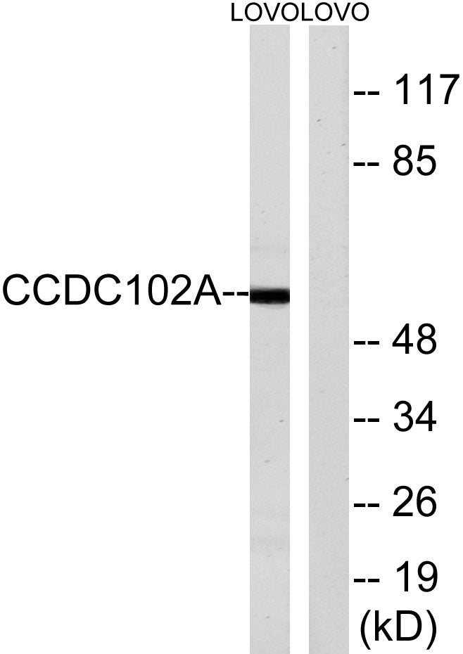 CCDC102A Rabbit Polyclonal Antibody