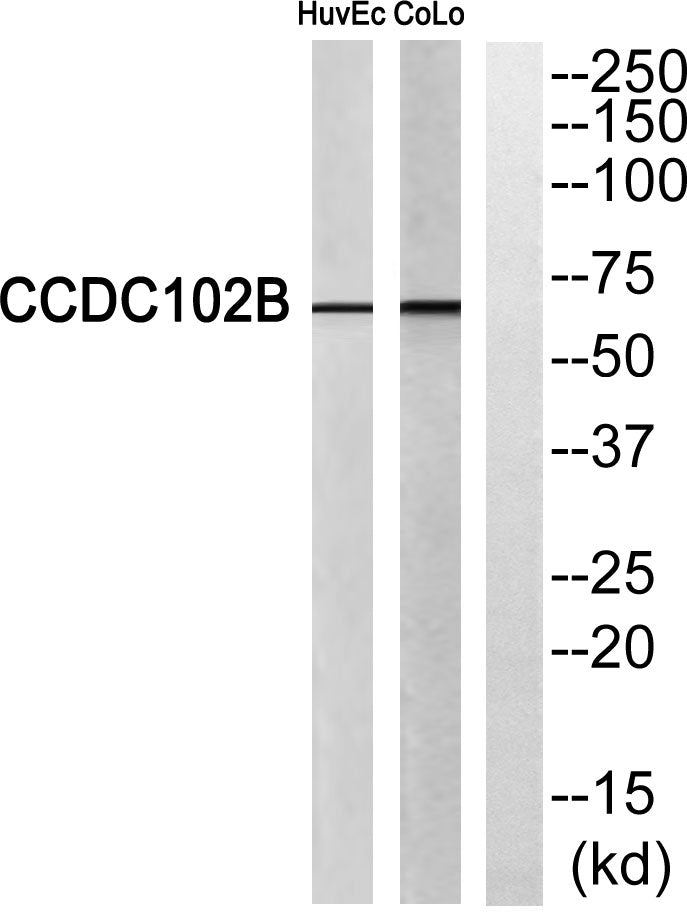 CCDC102B Rabbit Polyclonal Antibody