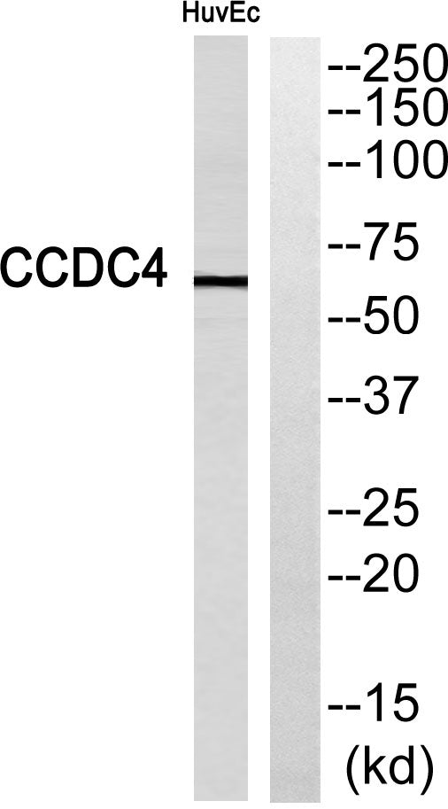 CCDC4 Rabbit Polyclonal Antibody