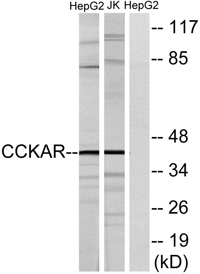 CCK-AR Rabbit Polyclonal Antibody