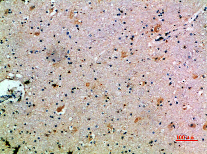 CCL14 Rabbit Polyclonal Antibody