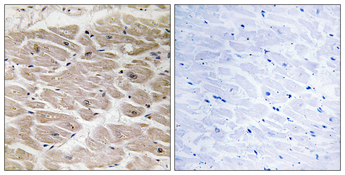 CCP2 Rabbit Polyclonal Antibody