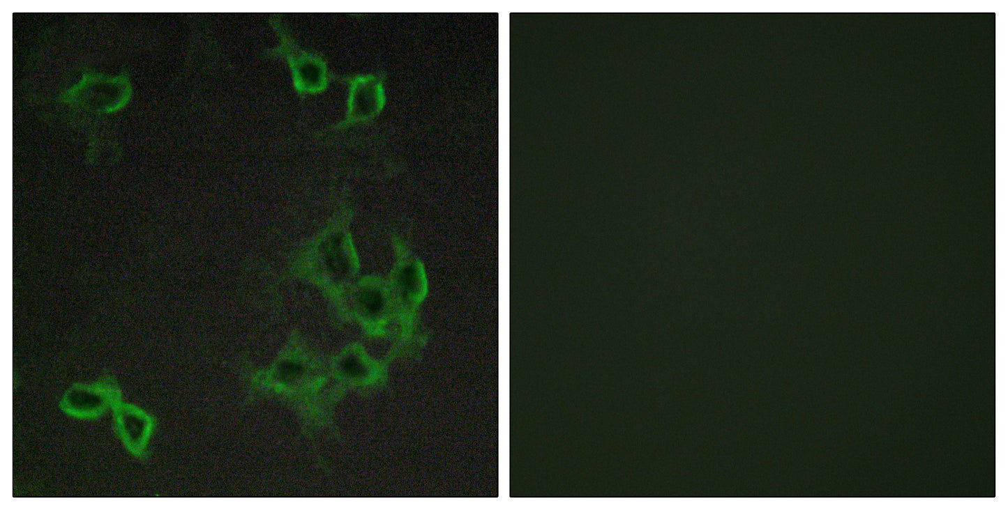 CCRL1 Rabbit Polyclonal Antibody