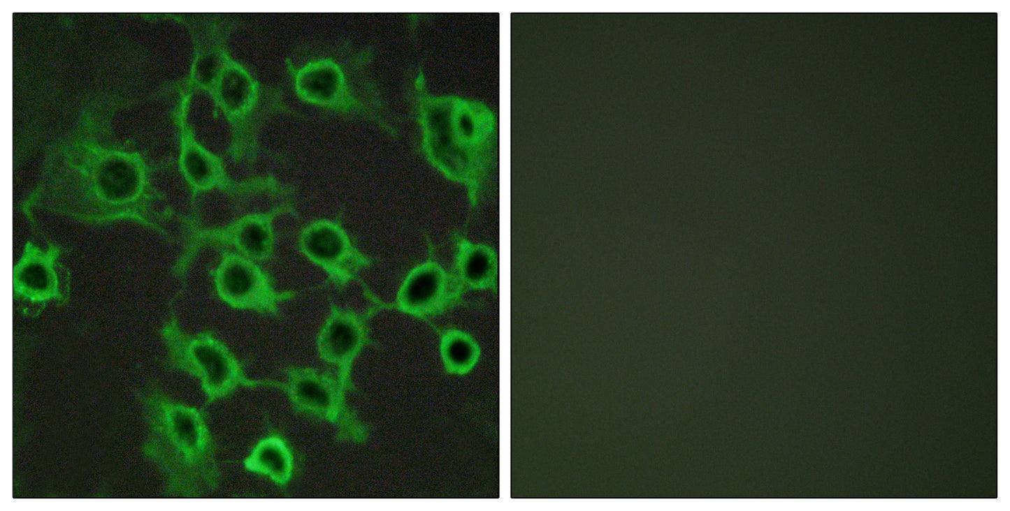 CCRL2 Rabbit Polyclonal Antibody