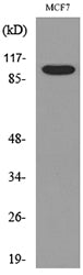CD100 Rabbit Polyclonal Antibody