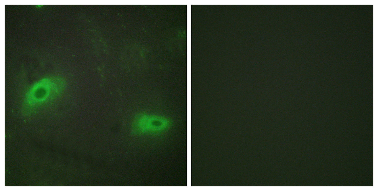 CD137L Rabbit Polyclonal Antibody