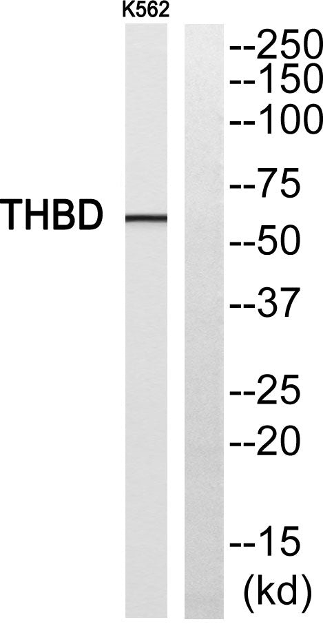 CD141 Rabbit Polyclonal Antibody