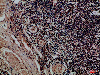 CD158f1/2 Rabbit Polyclonal Antibody