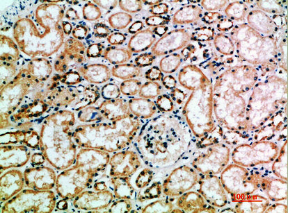 CD158k Rabbit Polyclonal Antibody
