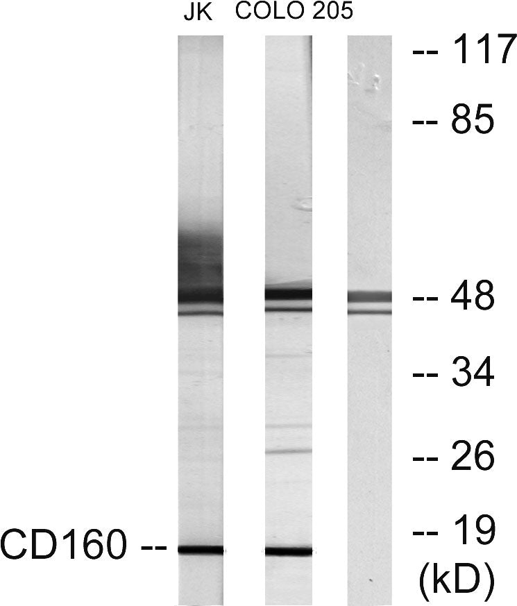 CD160 Rabbit Polyclonal Antibody