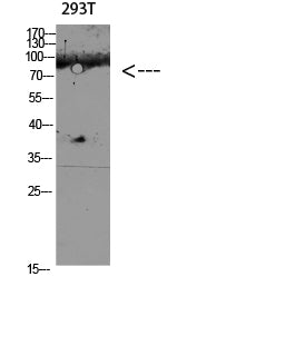 CD168 Rabbit Polyclonal Antibody
