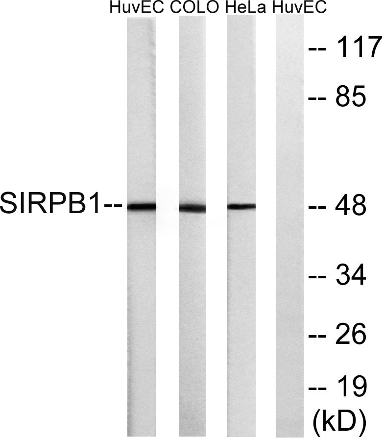 CD172b Rabbit Polyclonal Antibody