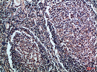 CD1A/B Rabbit Polyclonal Antibody