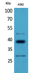 CD1D Rabbit Polyclonal Antibody