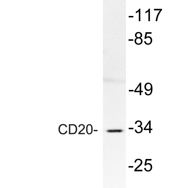 CD20 Rabbit Polyclonal Antibody