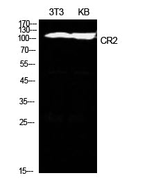 CD21 Rabbit Polyclonal Antibody