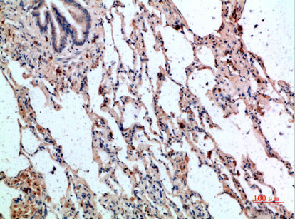 CD236 Rabbit Polyclonal Antibody