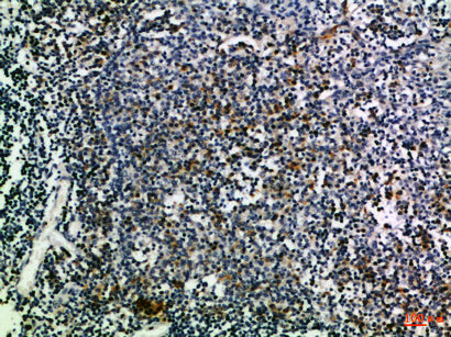 CD274 Rabbit Polyclonal Antibody
