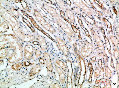 CD297 Rabbit Polyclonal Antibody