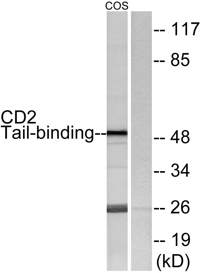 CD2BP2 Rabbit Polyclonal Antibody