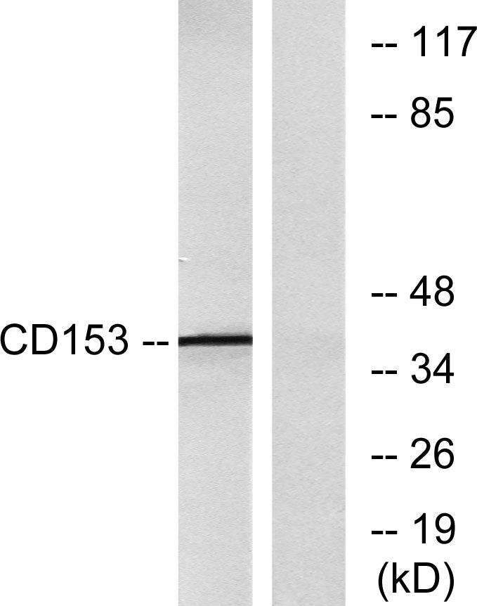 CD30-L Rabbit Polyclonal Antibody