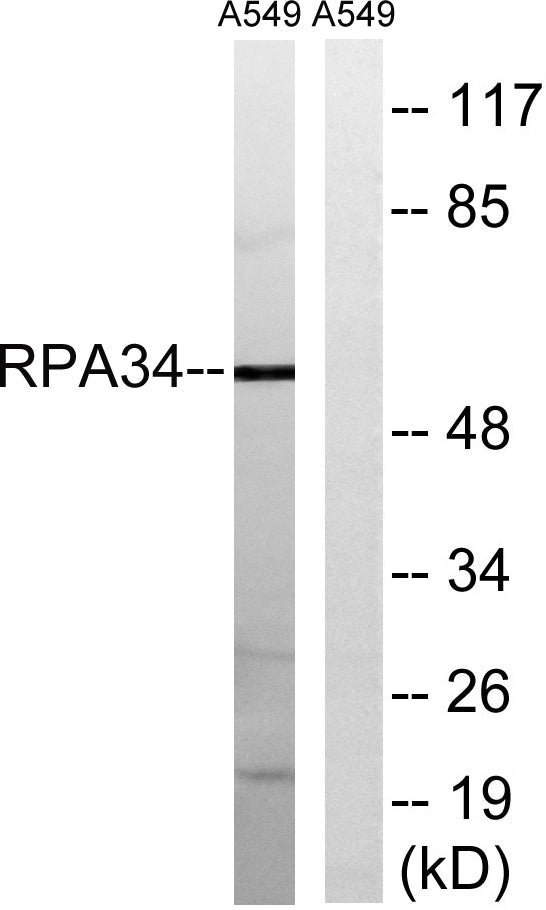CD3EAP Rabbit Polyclonal Antibody