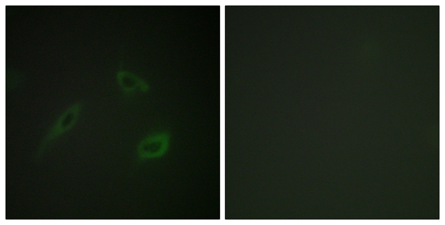 CD4 Rabbit Polyclonal Antibody