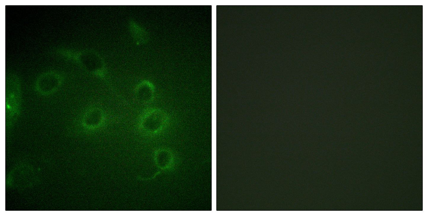 CD45 Rabbit Polyclonal Antibody