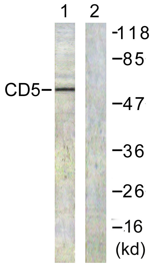 CD5 Rabbit Polyclonal Antibody