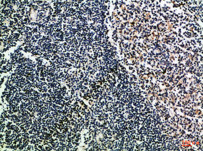 CD52 Rabbit Polyclonal Antibody