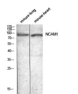 CD56 Rabbit Polyclonal Antibody