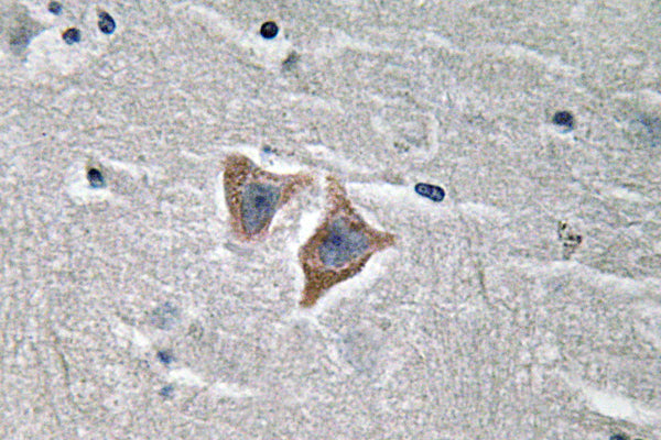 CD57 Rabbit Polyclonal Antibody