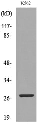 CD58 Rabbit Polyclonal Antibody