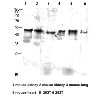 CD64 Rabbit Polyclonal Antibody