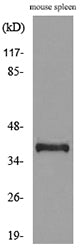 CD68 Rabbit Polyclonal Antibody
