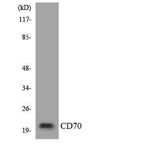 CD70 Rabbit Polyclonal Antibody
