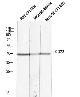 CD72 Rabbit Polyclonal Antibody