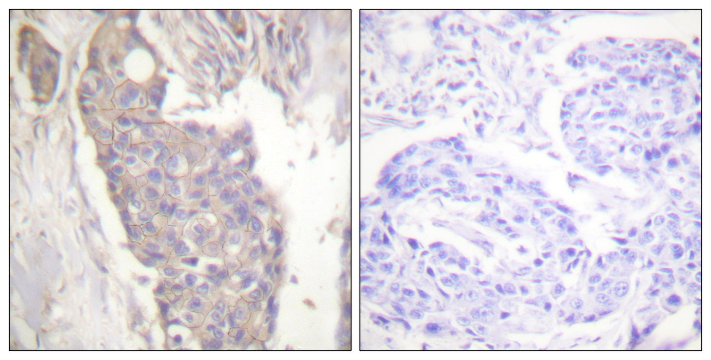 CD95 Rabbit Polyclonal Antibody