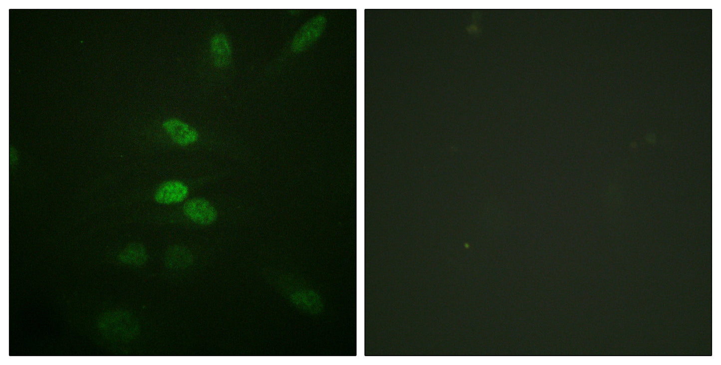 Cdc25B Rabbit Polyclonal Antibody