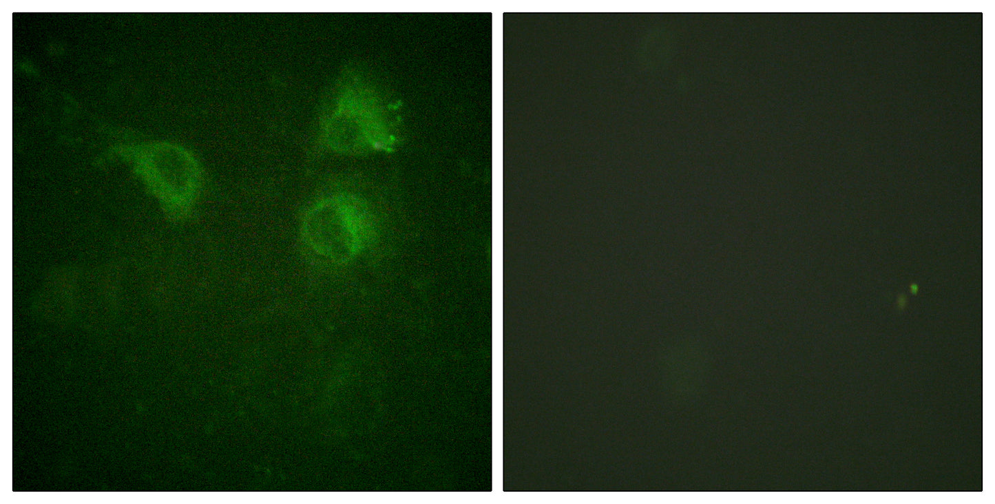 Cdc25B Rabbit Polyclonal Antibody