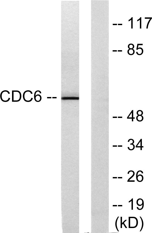 Cdc6 Rabbit Polyclonal Antibody