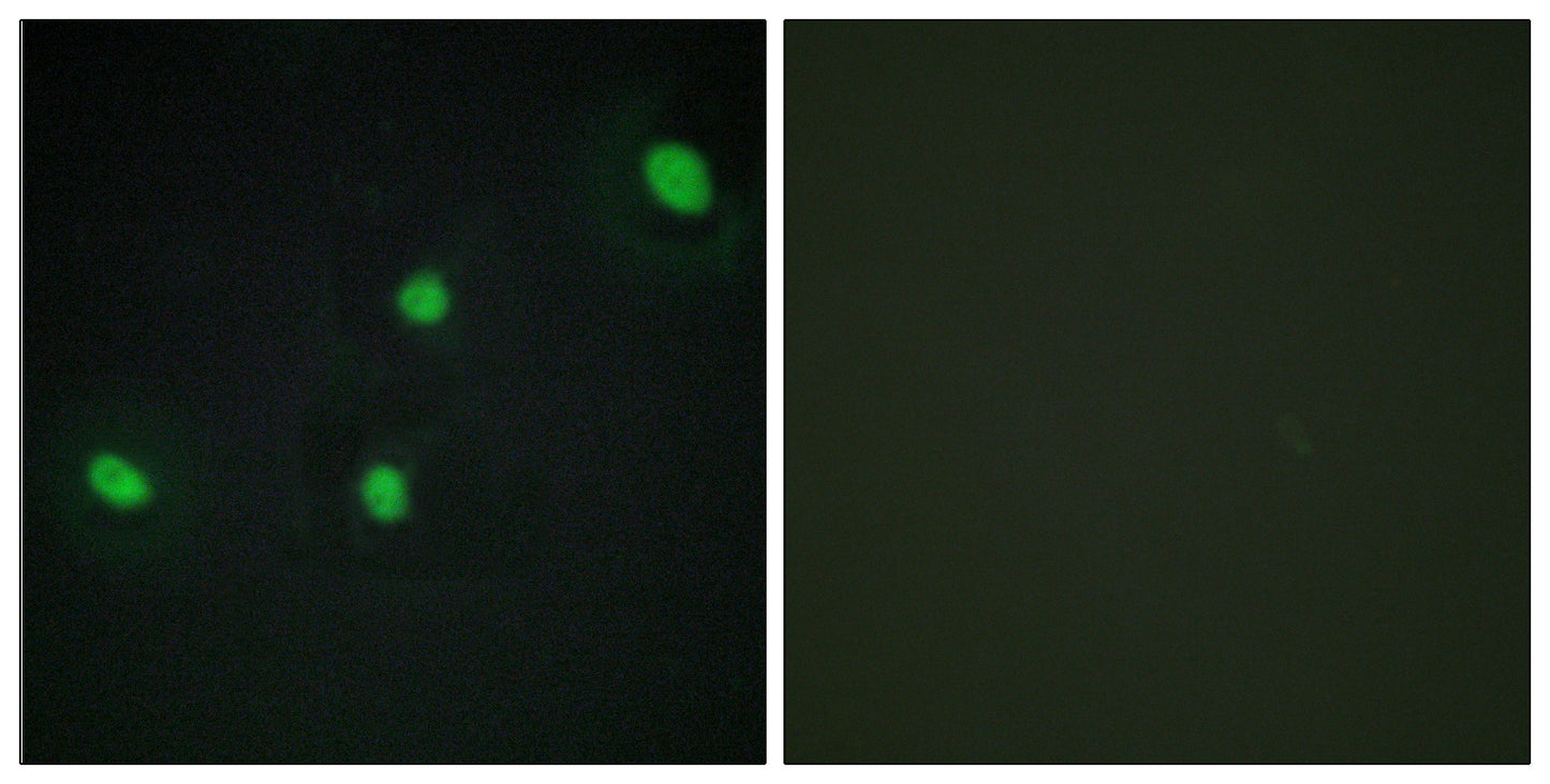 CdcA4 Rabbit Polyclonal Antibody