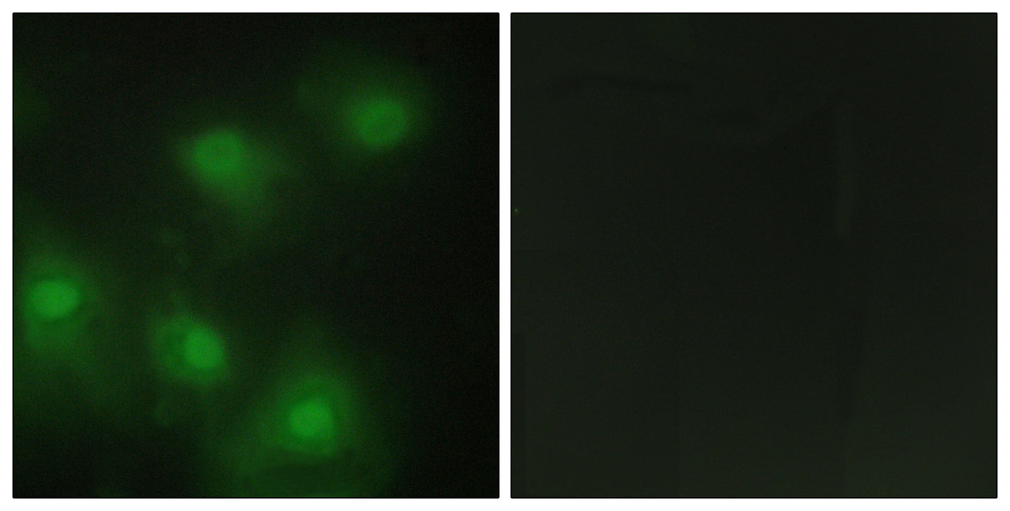 Cdk2 Rabbit Polyclonal Antibody
