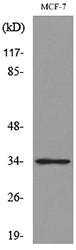 Cdk4 Rabbit Polyclonal Antibody