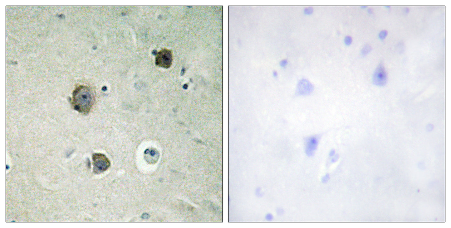 Cdk5 Rabbit Polyclonal Antibody